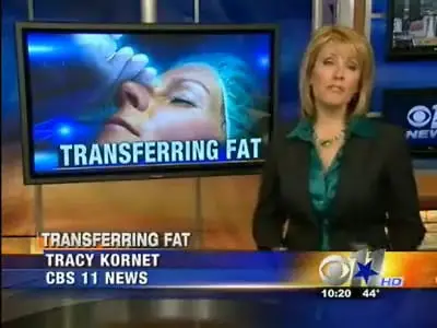 Regenerative Longevity Protocol with FAMI stem cell treatment at Innovations Stem Cell Center Dallas on CBS 11 News